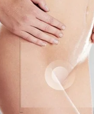 Illustrative photograph showing the lower abdomen and intimate-care area without exposed genitals
